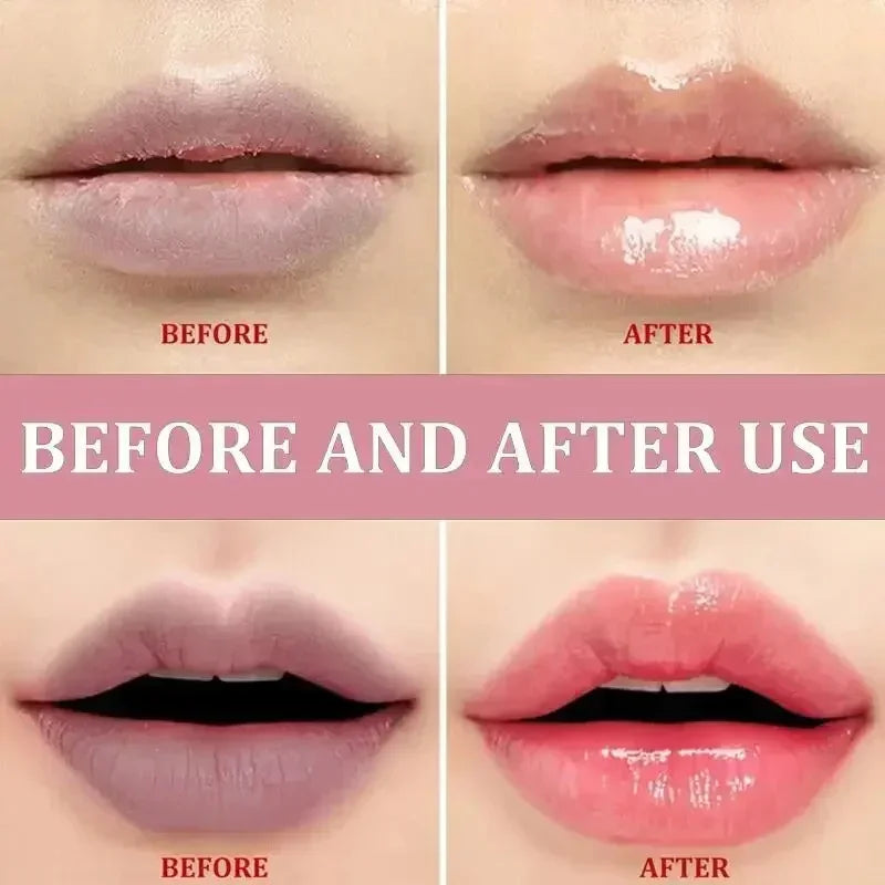 Lip Balm