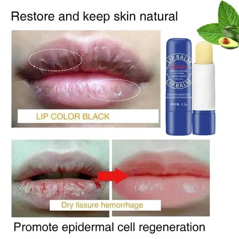 Lip Balm